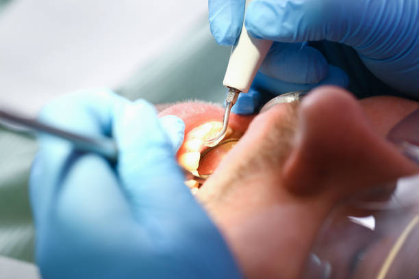 Urgent Tooth Repair in NY