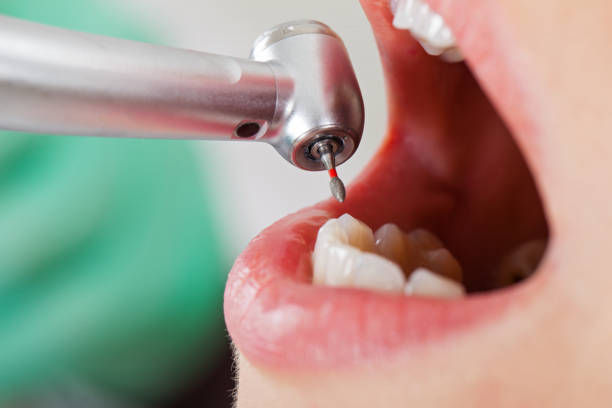 Best Broken Tooth Emergency  in Centerport, NY